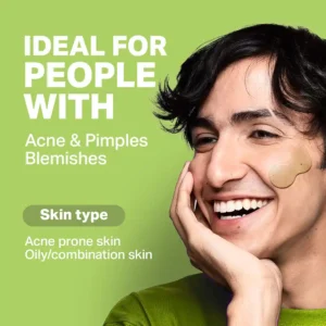 Anti Acne Face Wash, 150g  Fights Pimples & Excess Oil